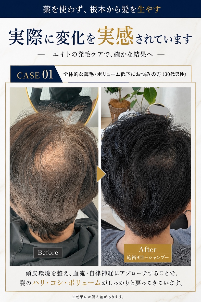 発毛施術の症例1
