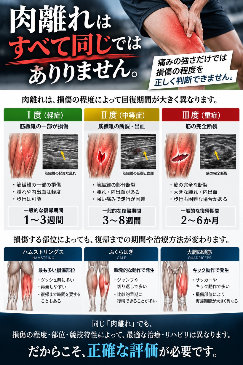肉離れは重症度や損傷部位によって異なります